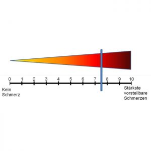 Visuelle Analog Skala - VAS (Quelle: wikimedia.org)