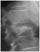 Röntgenbilder mit Genehmigung vom Orthopädischen Spital Speising